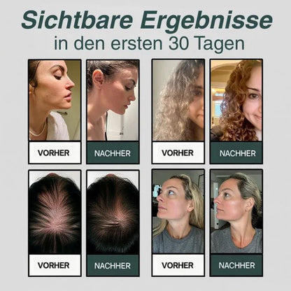 HYDROLUXE™ – Entfernt Chlor und Kalk aus deiner Dusche